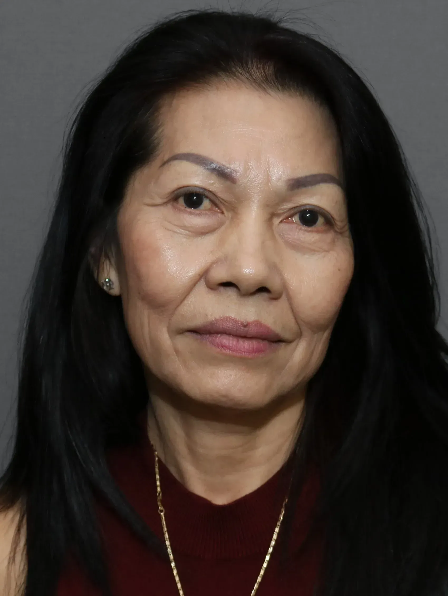 Facelift #4 before